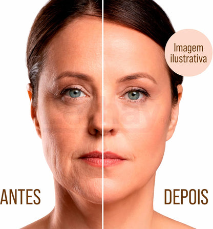 Kit 2 Escova Facial Massageadora Para Drenagem Linfática-2 Pcs(2 Pcs)